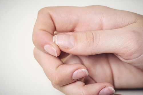Kruche paznokcie — przyczyny, objawy i sposoby zapobiegania łamliwości