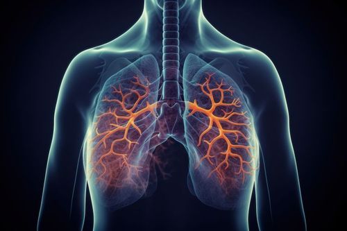 Zapalenie płuc – objawy i leczenie